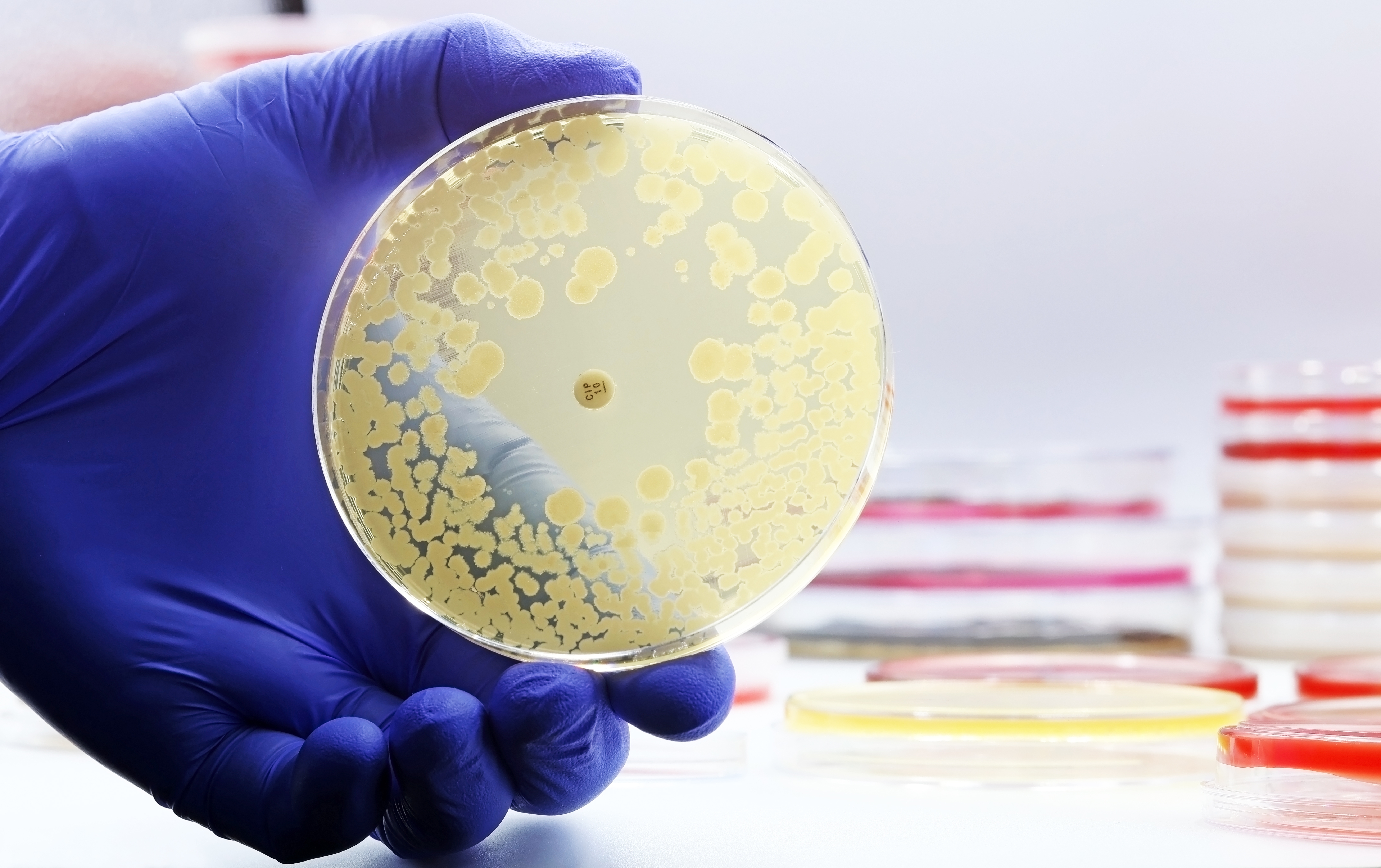 Bacteria growing in a petri dish